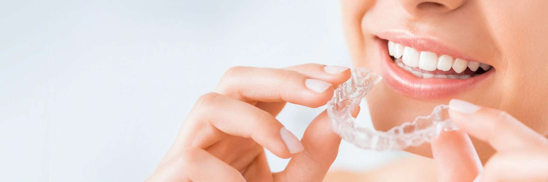 Invisalign® Clear Aligners | Dentist