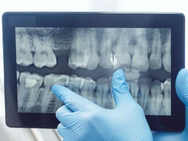 medium_digital x rays