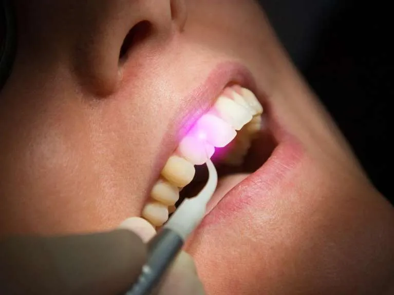 medium_laser-dentistry