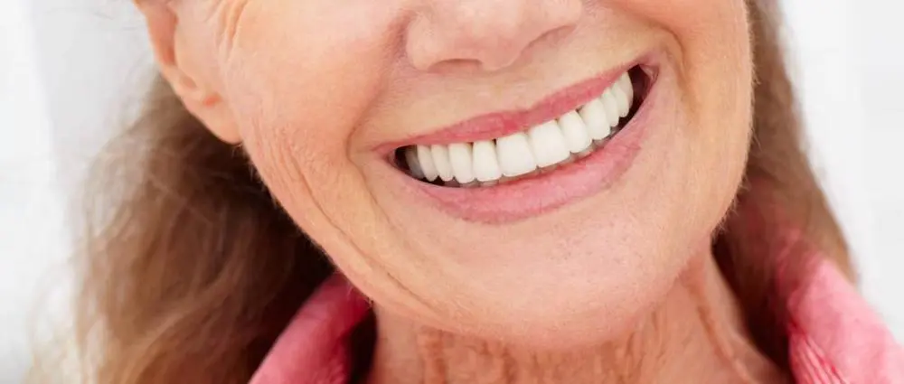 Porcelain Veneers Image
